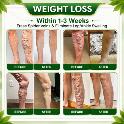 🇺🇸👩‍⚕️𝐎𝐟𝐟𝐢𝐜𝐢𝐚𝐥 𝐁𝐫𝐚𝐧𝐝 𝐒𝐭𝐨𝐫𝐞 |🌿𝑮𝒓𝒆𝒆𝒏𝑭𝒆𝒆𝒍® 𝑩𝒆𝒓𝒃𝒆𝒓𝒊𝒏𝒆 𝑴𝒐𝒓𝒊𝒏𝒈𝒂- 𝑩𝒆𝒆 𝑽𝒆𝒏𝒐𝒎 Metabolic Wellness Foot Soak Beads