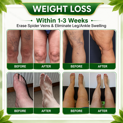 🇺🇸👩‍⚕️𝐎𝐟𝐟𝐢𝐜𝐢𝐚𝐥 𝐁𝐫𝐚𝐧𝐝 𝐒𝐭𝐨𝐫𝐞 |🌿𝑮𝒓𝒆𝒆𝒏𝑭𝒆𝒆𝒍® 𝑩𝒆𝒓𝒃𝒆𝒓𝒊𝒏𝒆 𝑴𝒐𝒓𝒊𝒏𝒈𝒂- 𝑩𝒆𝒆 𝑽𝒆𝒏𝒐𝒎 Metabolic Wellness Foot Soak Beads