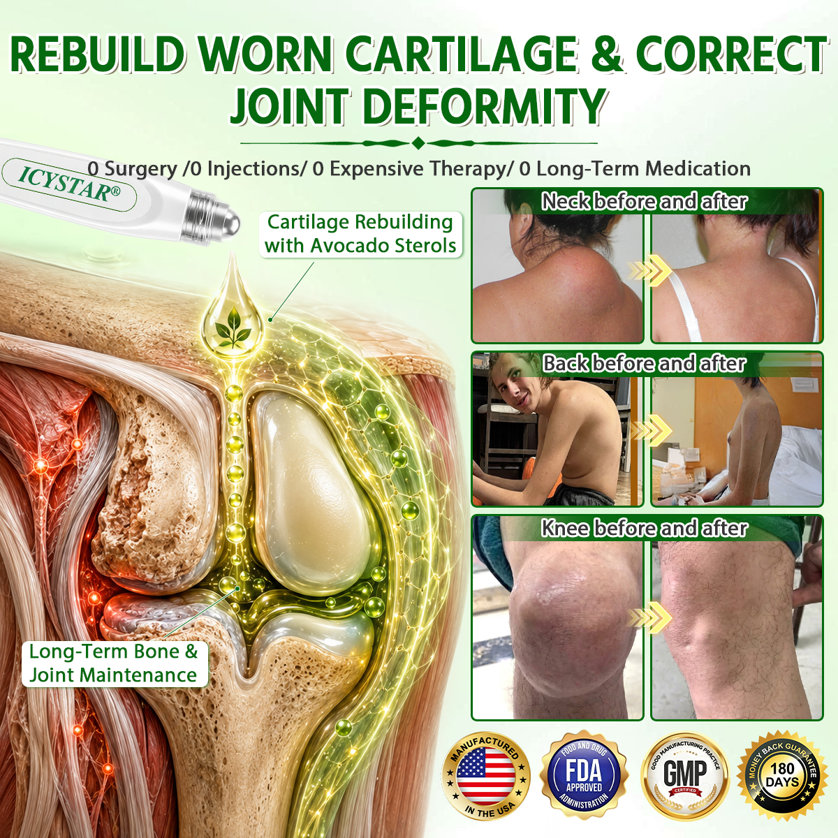 Limited to 10 packs 🌟 ICYSTAR®—Exclusive 30% discount, reclaim your pain-free mobility! A rare opportunity — won't be available again until next year, don’t miss out! 180-Day Money-Back Guarantee, full refund with absolutely no risk!