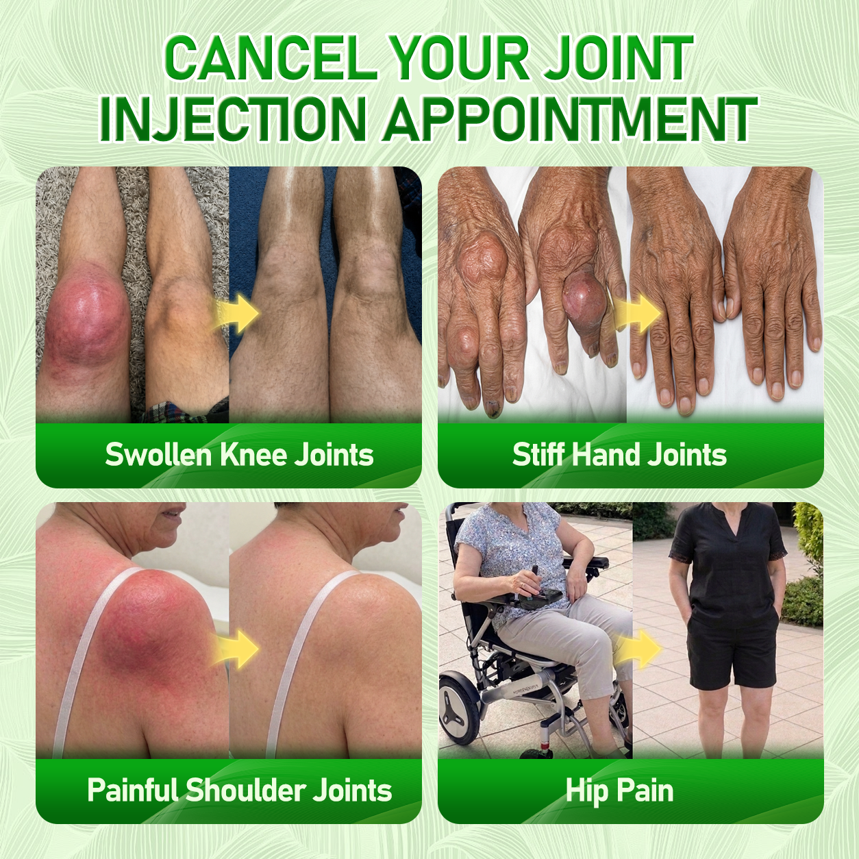 Limited to 10 packs 🌟 ICYSTAR®—Exclusive 30% discount, reclaim your pain-free mobility! A rare opportunity — won't be available again until next year, don’t miss out! 180-Day Money-Back Guarantee, full refund with absolutely no risk!