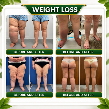 🇺🇸👩‍⚕️𝐎𝐟𝐟𝐢𝐜𝐢𝐚𝐥 𝐁𝐫𝐚𝐧𝐝 𝐒𝐭𝐨𝐫𝐞 |🌿𝑮𝒓𝒆𝒆𝒏𝑭𝒆𝒆𝒍® 𝑩𝒆𝒓𝒃𝒆𝒓𝒊𝒏𝒆 𝑴𝒐𝒓𝒊𝒏𝒈𝒂- 𝑩𝒆𝒆 𝑽𝒆𝒏𝒐𝒎 Metabolic Wellness Foot Soak Beads