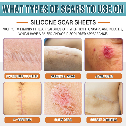 Icystar®Tranexamic Acid silicone scar sheets——Fade Scars · Brighten Dark Spots · Firm Loose Skin